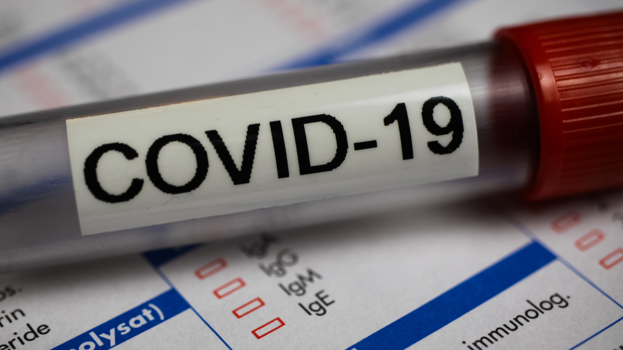 Corona virus covid-19 diagnostic, vaccination and research concept: macro closeup of isolated blood sample vial on laboratory requisition slip. Image Credit: Adobe Stock Images/Ralf